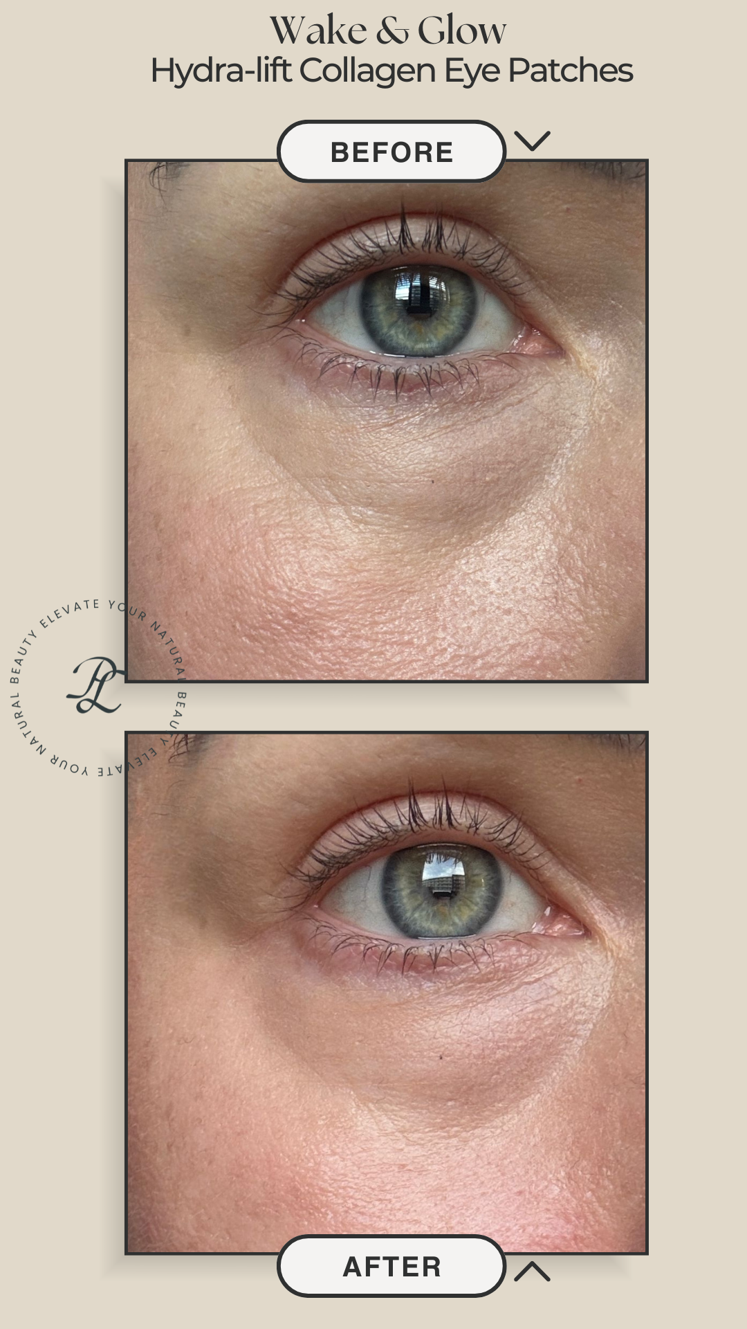before after wake glow oogmasker eye patches